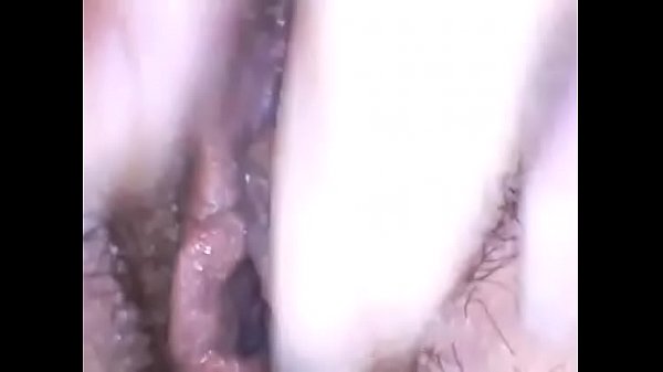 Exploración de hermoso coño peludo con endoscopio médico disfruta